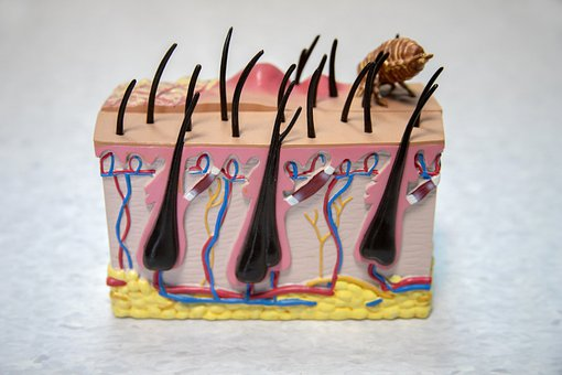 Illustration of skin layers and pimples