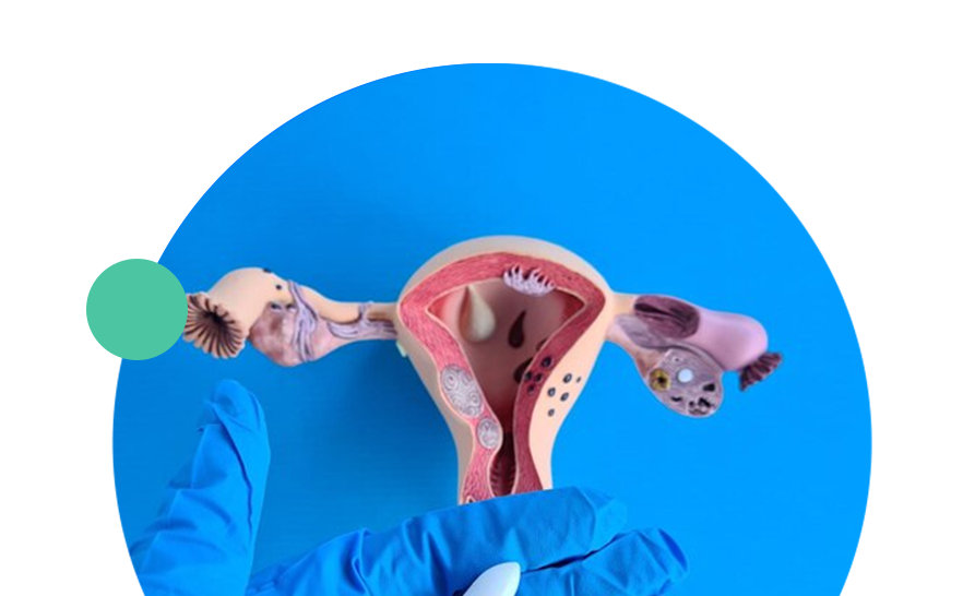 Bacterial Vaginosis