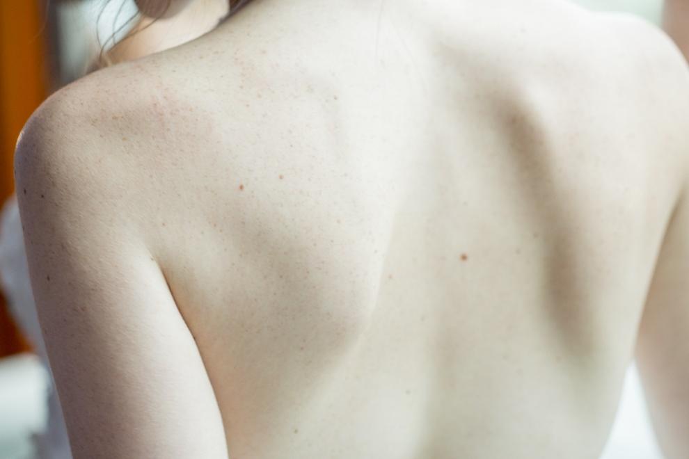  A person’s back
