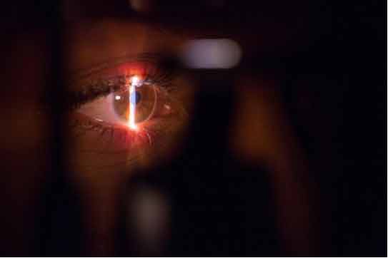 eye inspection for stye